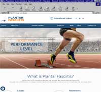 Plantar Fasciitis